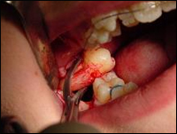 Solution of dental problem in Ahmedabad , Dentist in Ahmedabad